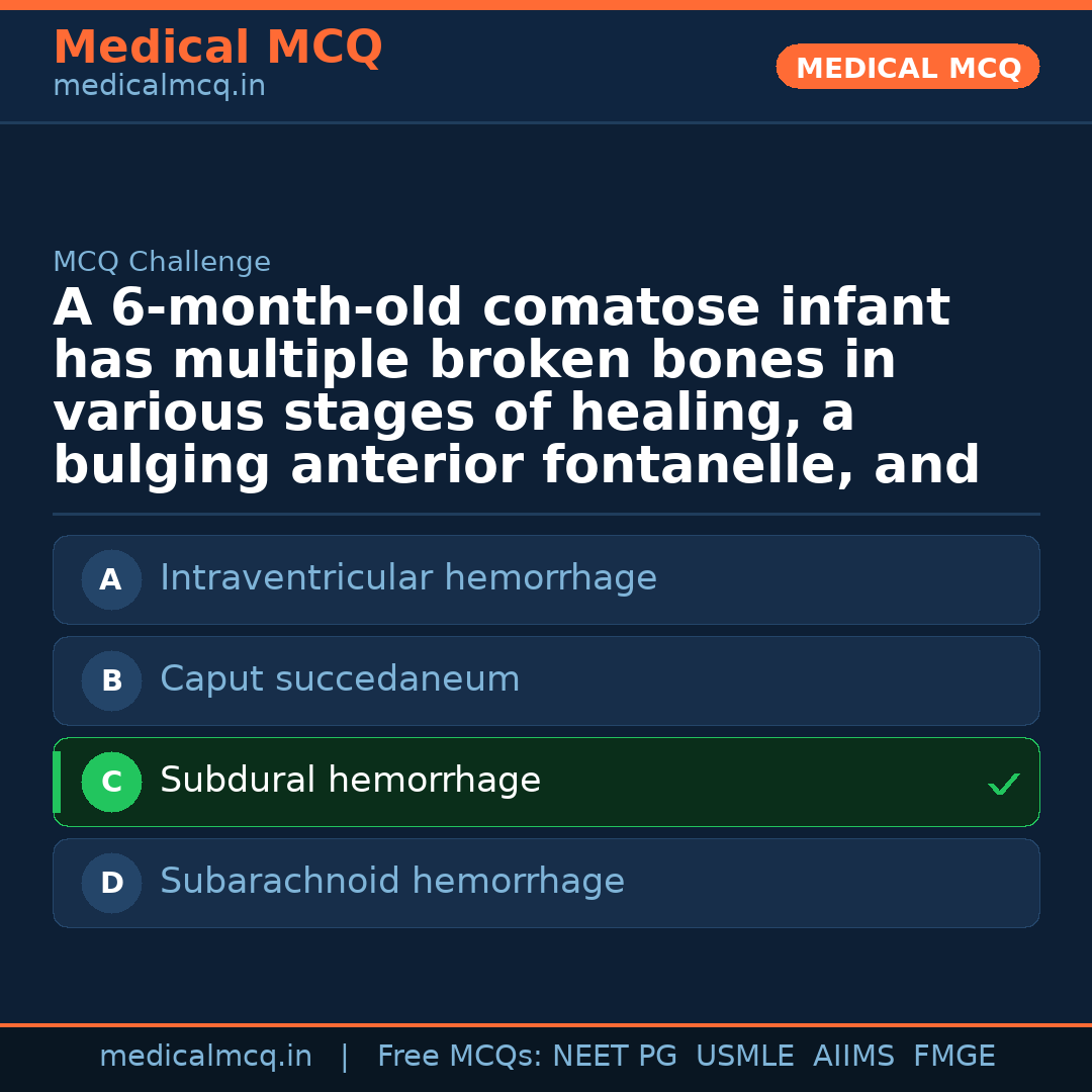 MCQ share card