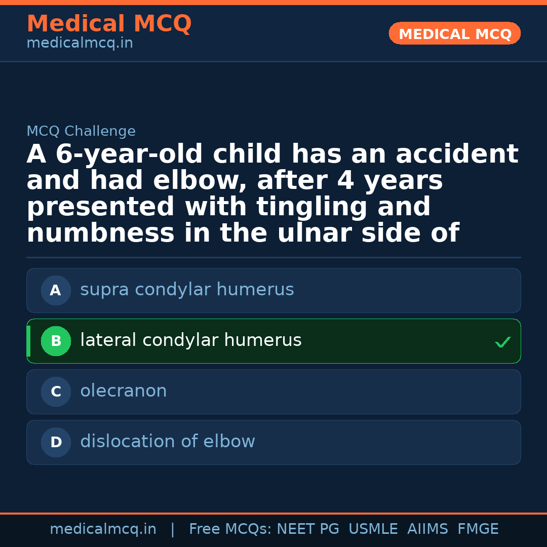MCQ share card