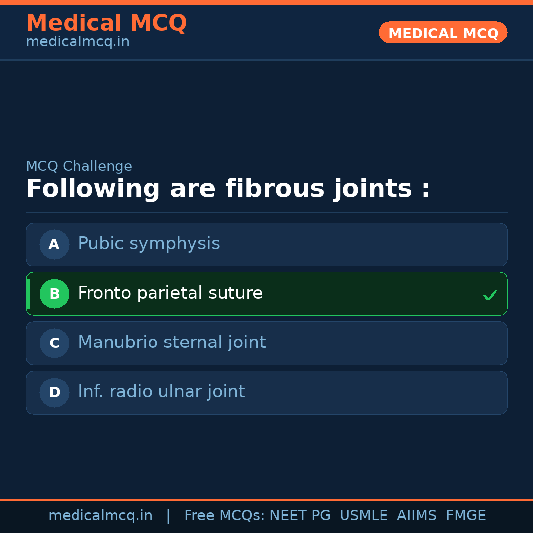 MCQ share card