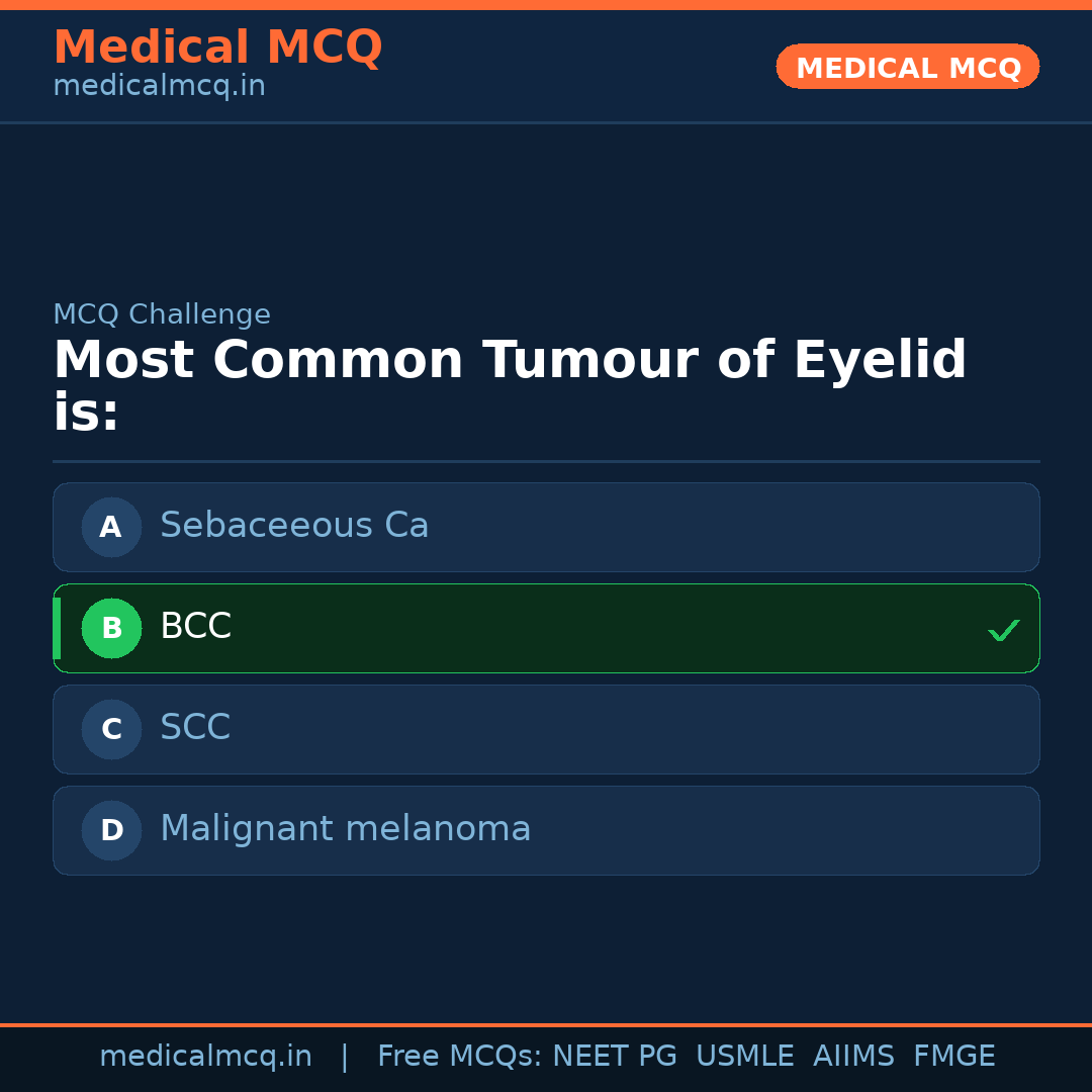 MCQ share card