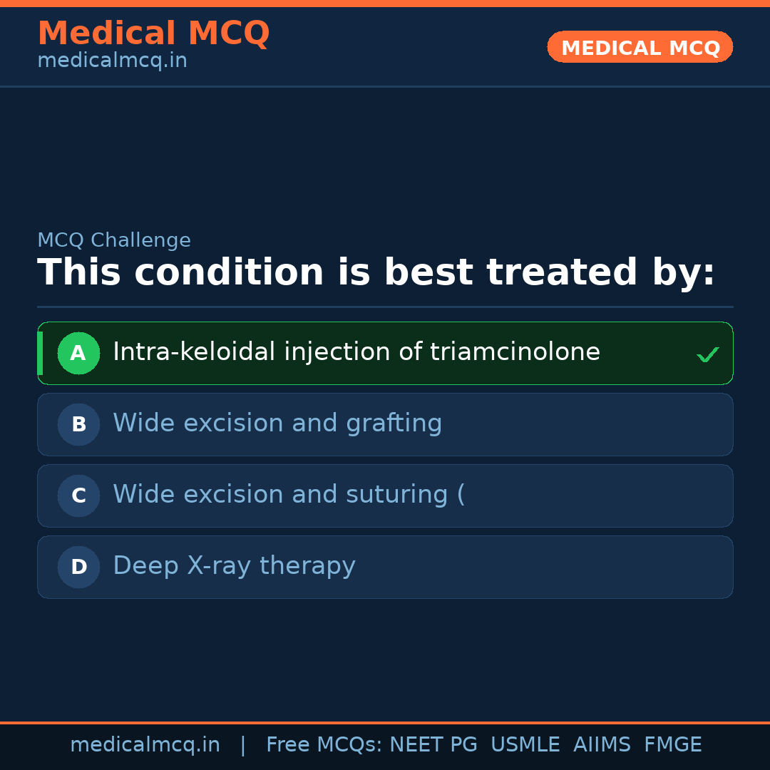 MCQ share card