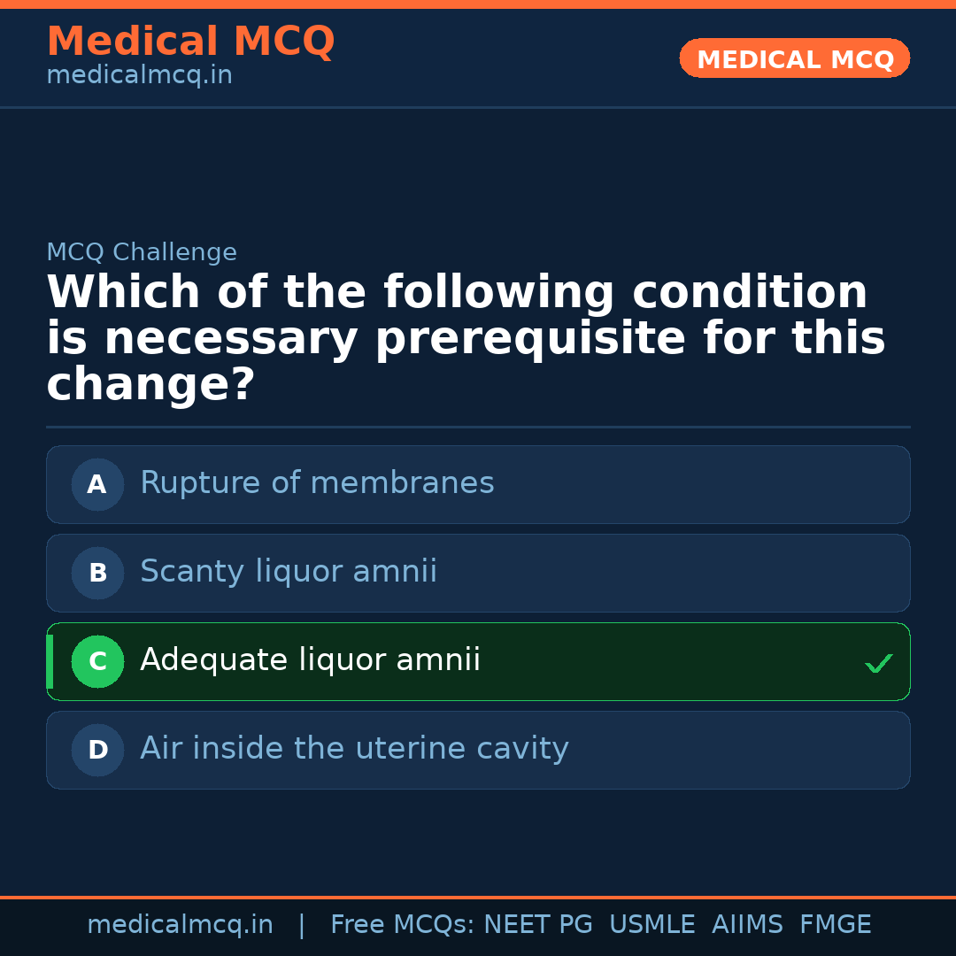 MCQ share card