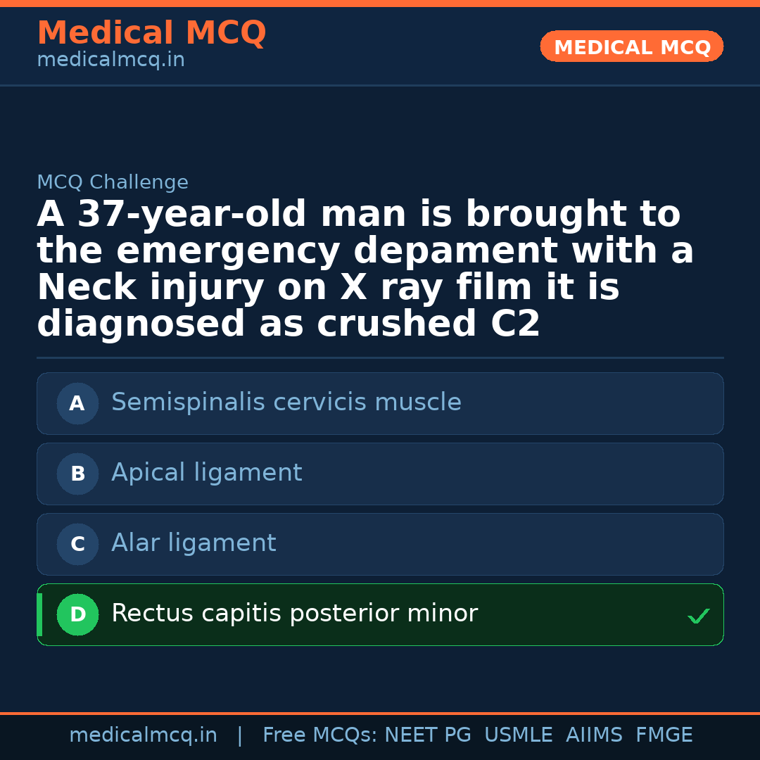 MCQ share card