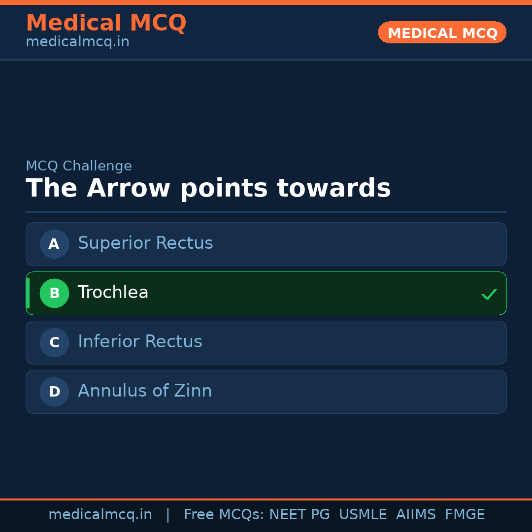 MCQ share card