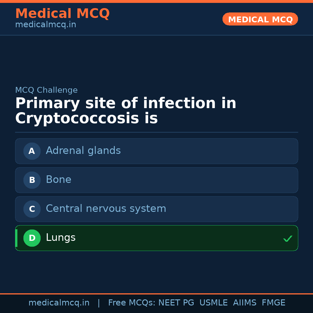 MCQ share card