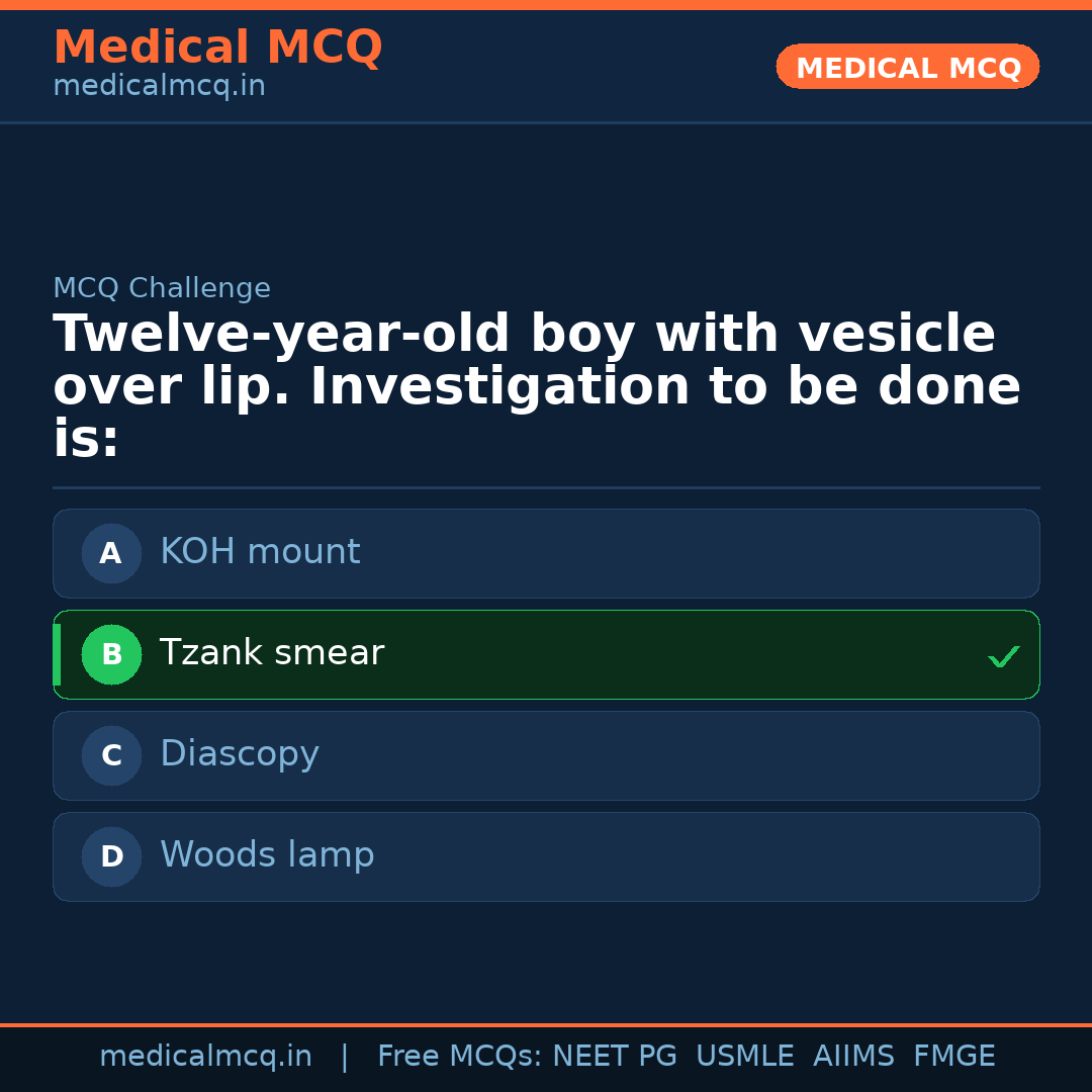 MCQ share card