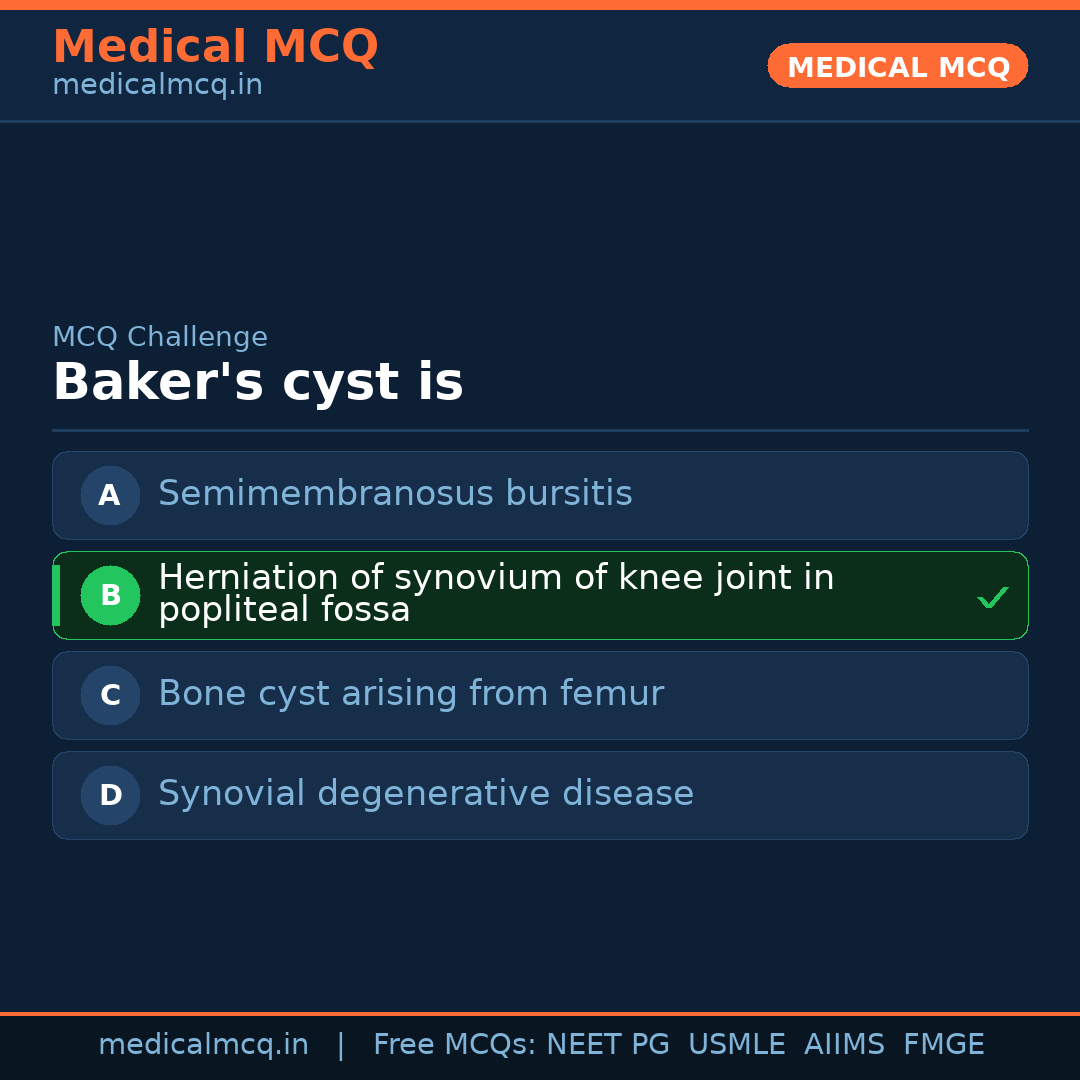 MCQ share card