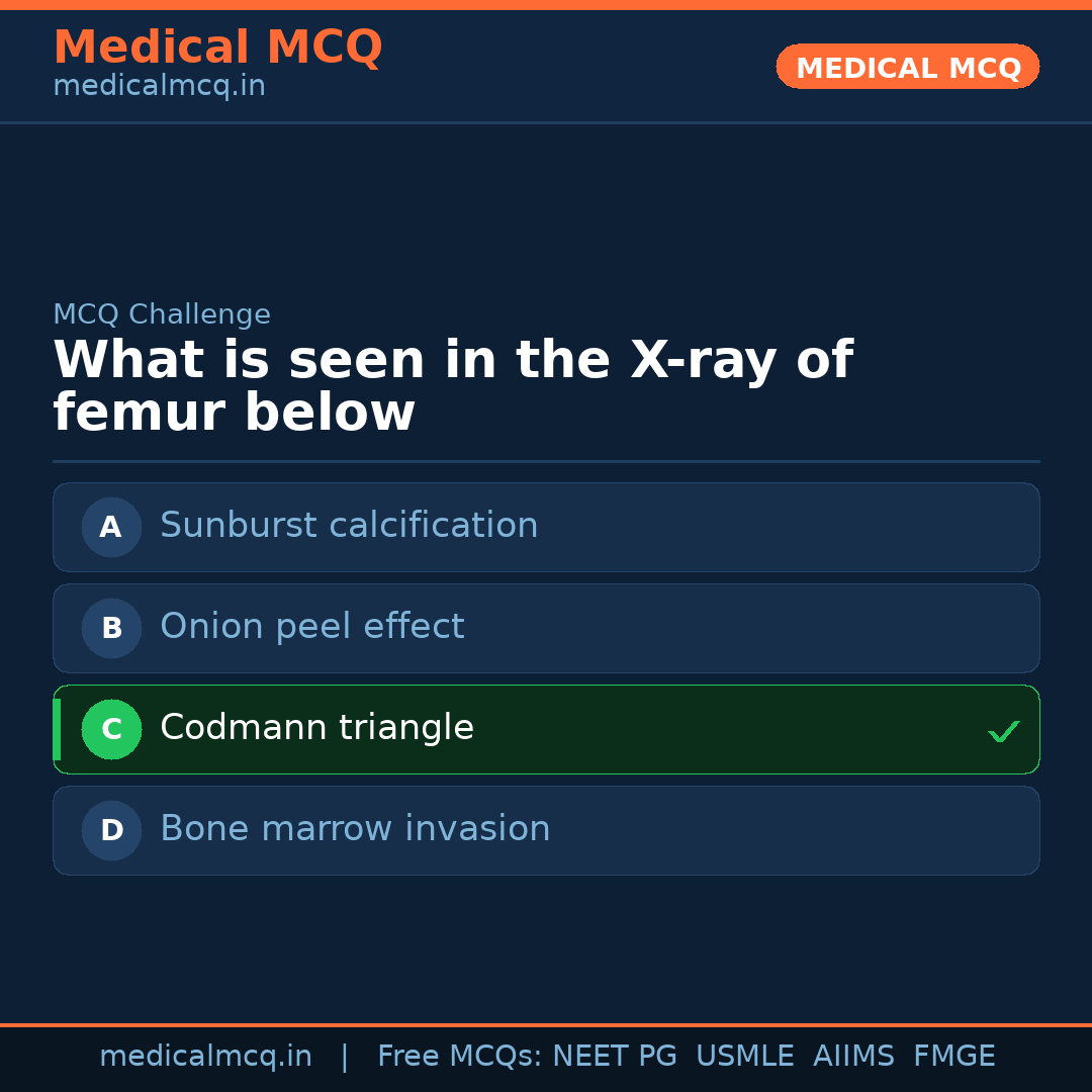 MCQ share card