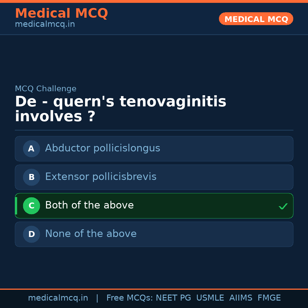 MCQ share card