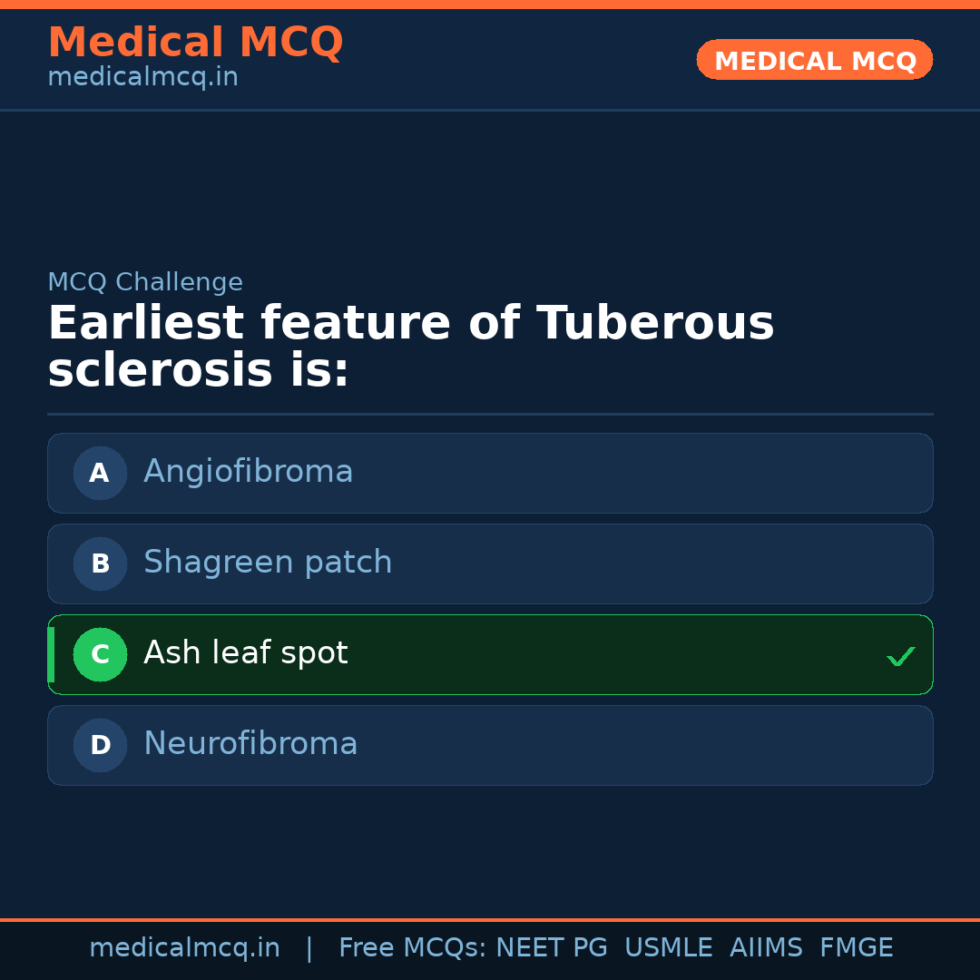 MCQ share card
