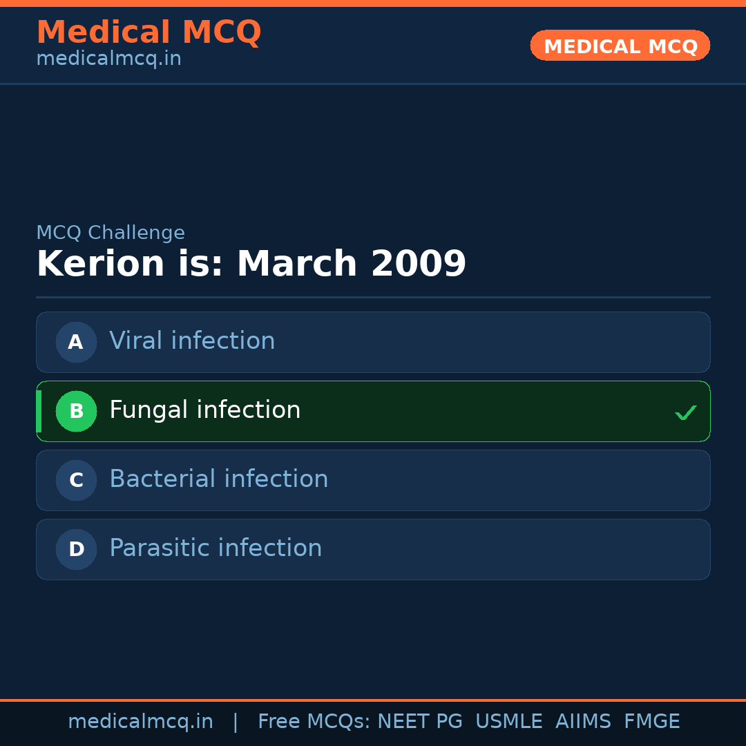 MCQ share card