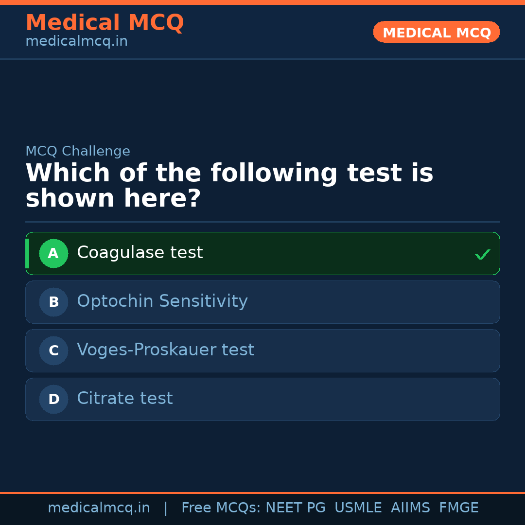 MCQ share card