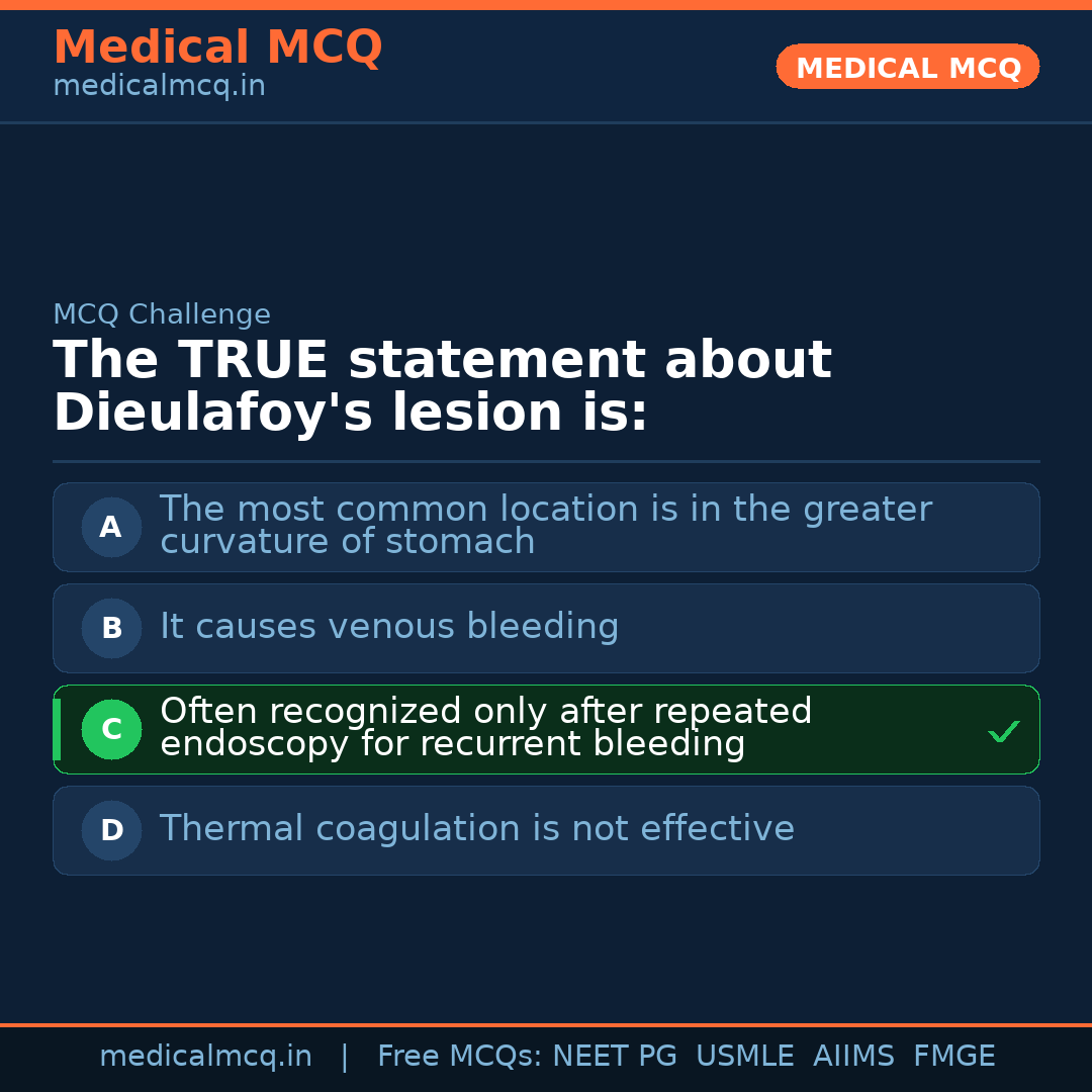 MCQ share card