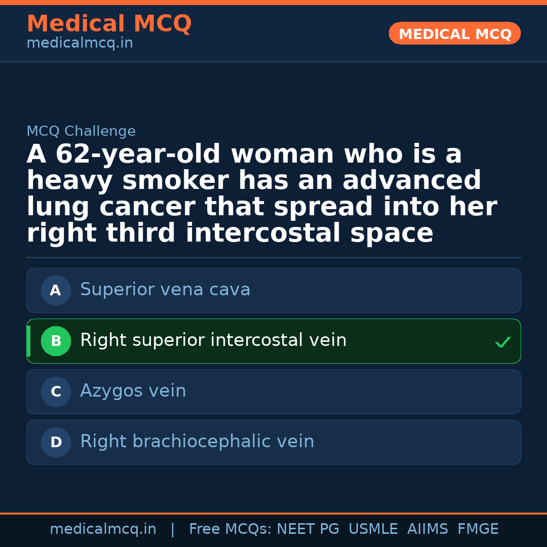 MCQ share card