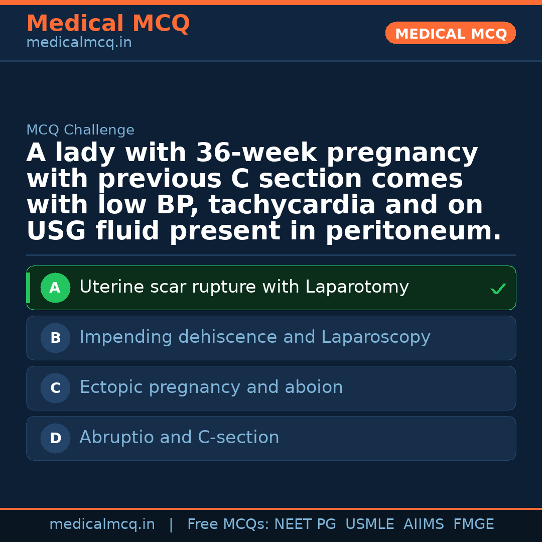 MCQ share card