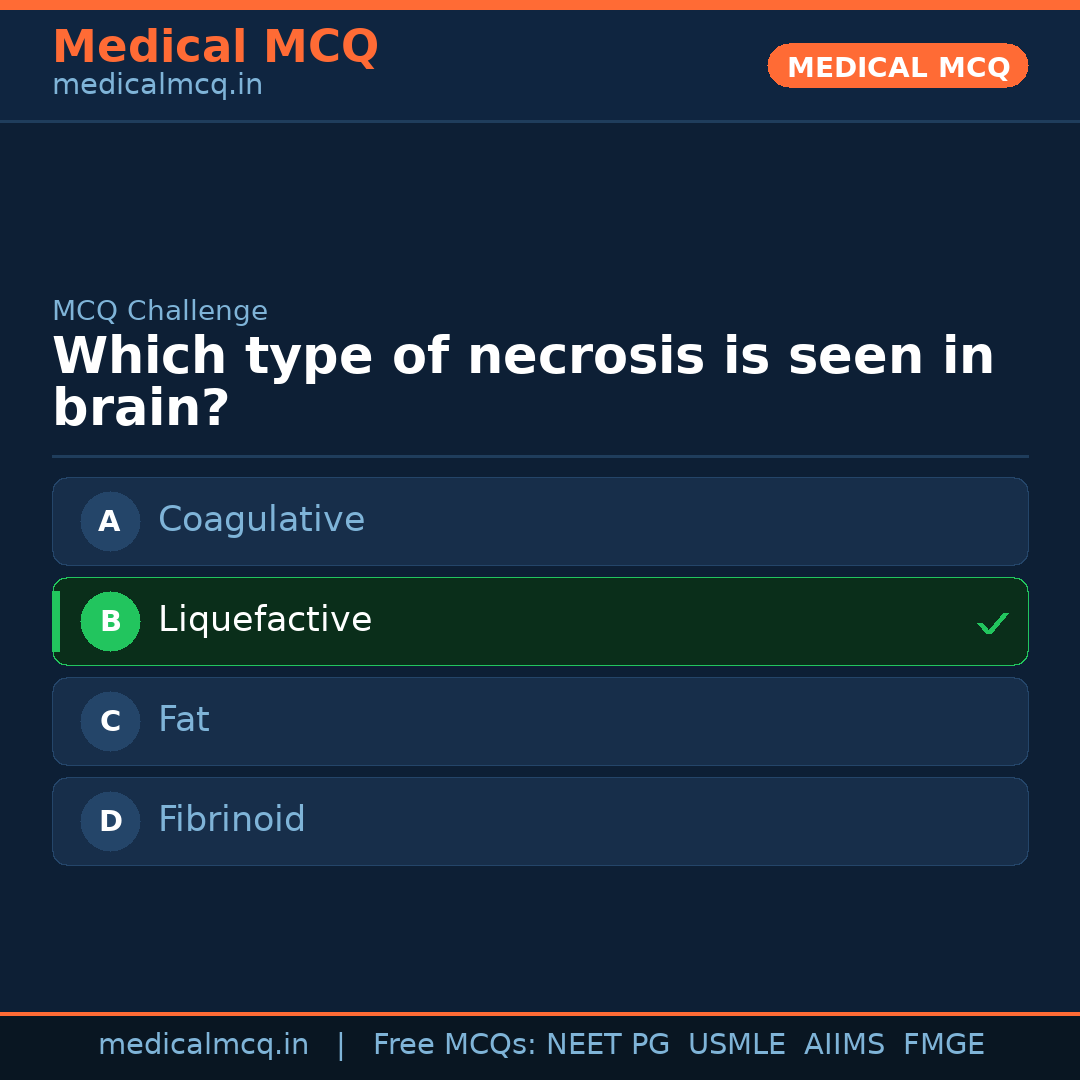 MCQ share card