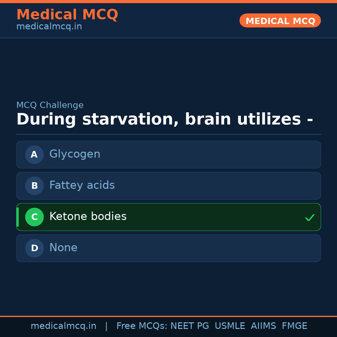 MCQ share card