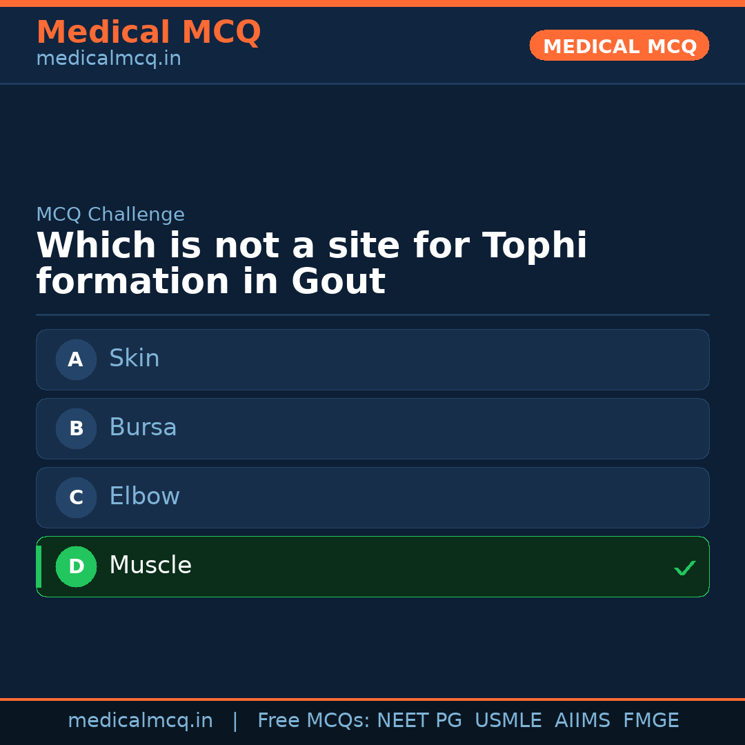 MCQ share card