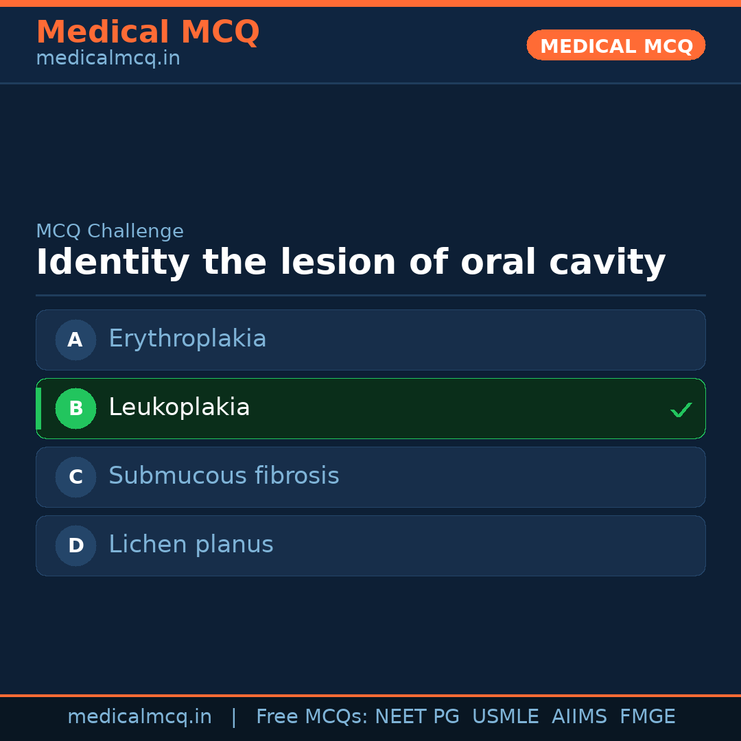 MCQ share card