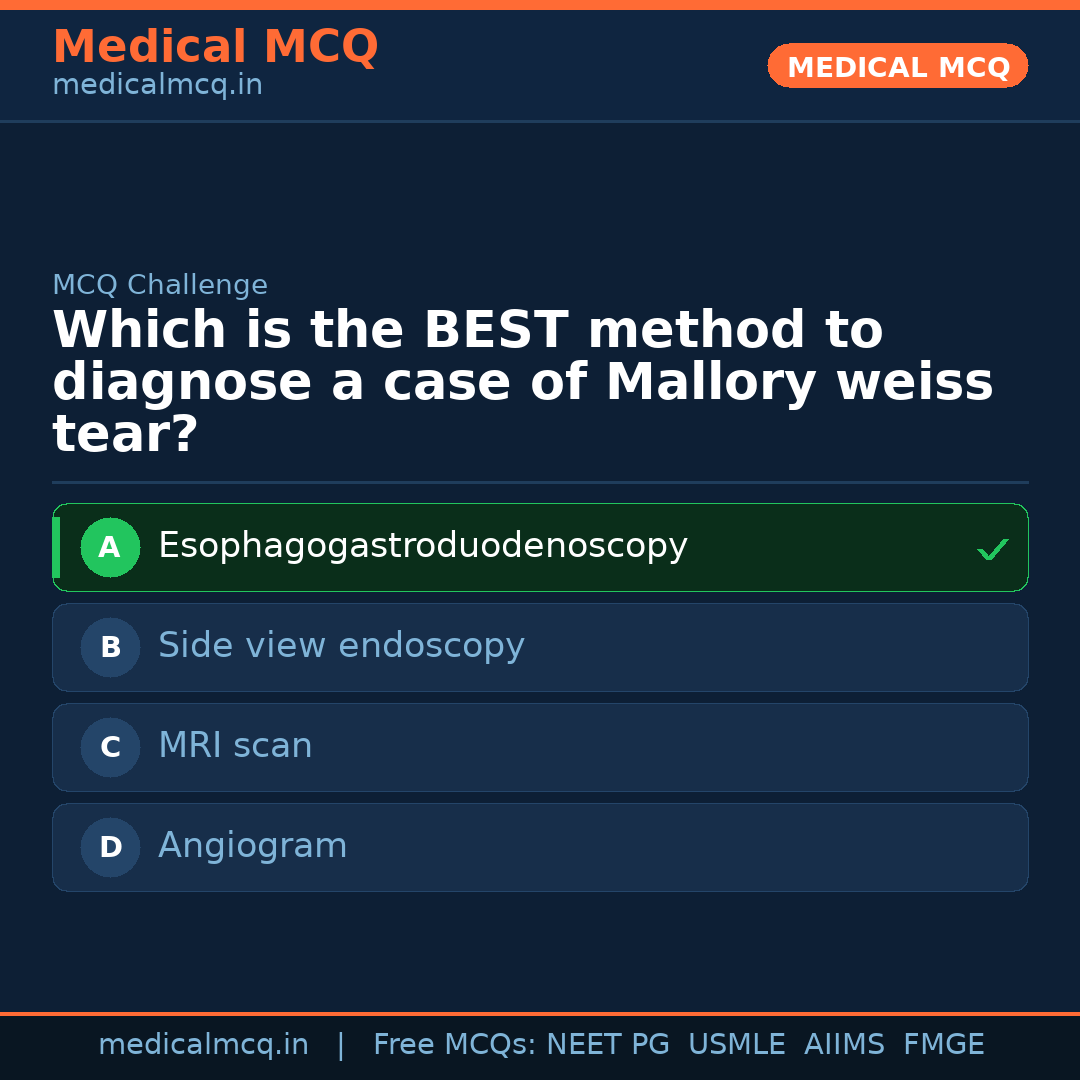MCQ share card