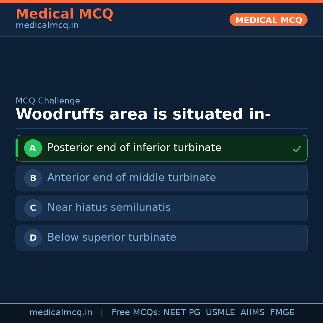 MCQ share card