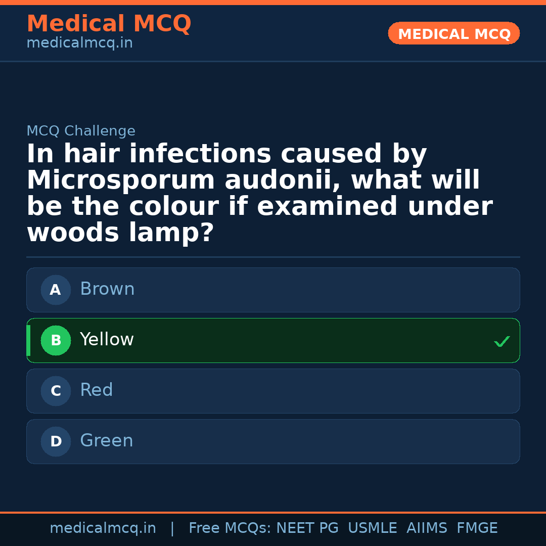 MCQ share card