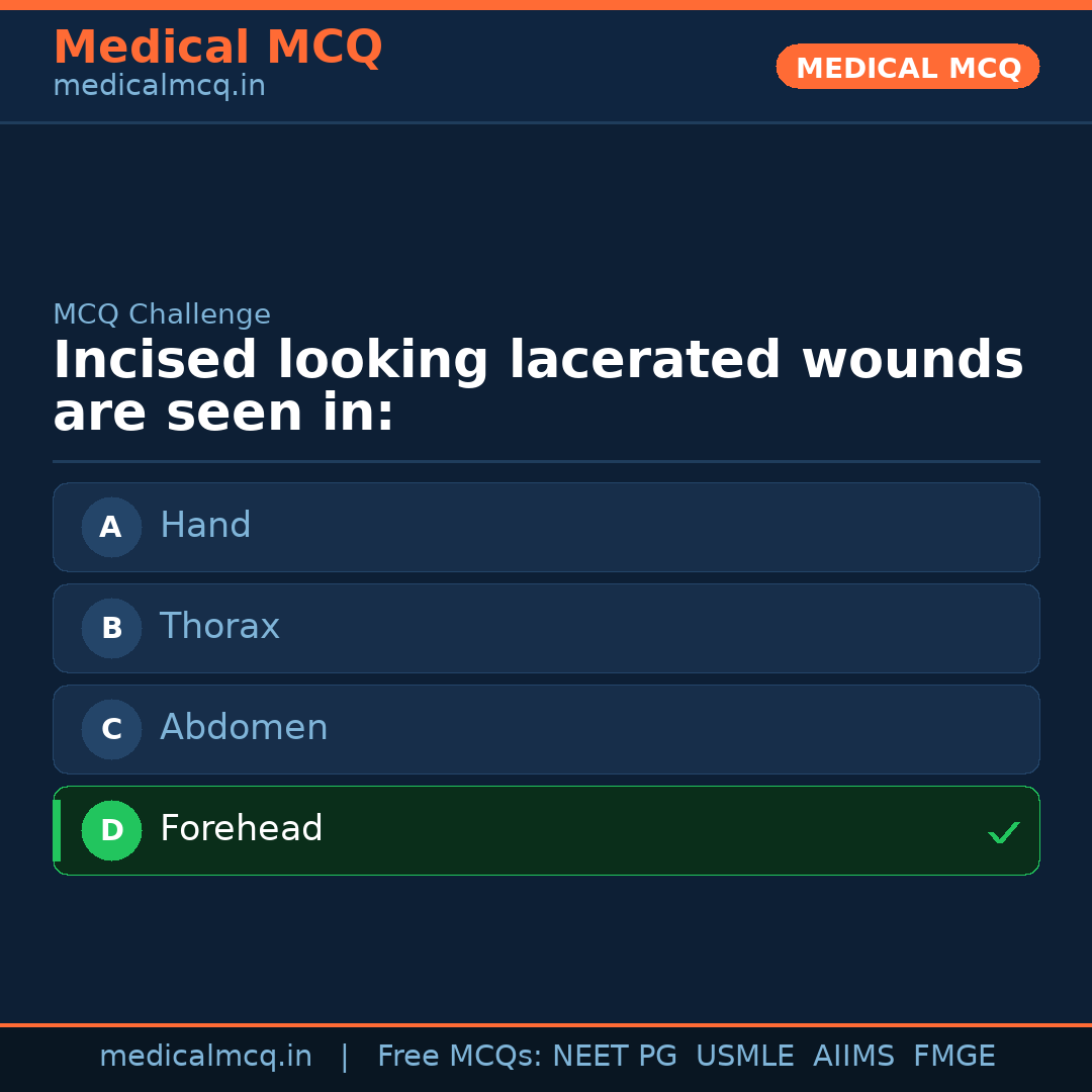 MCQ share card