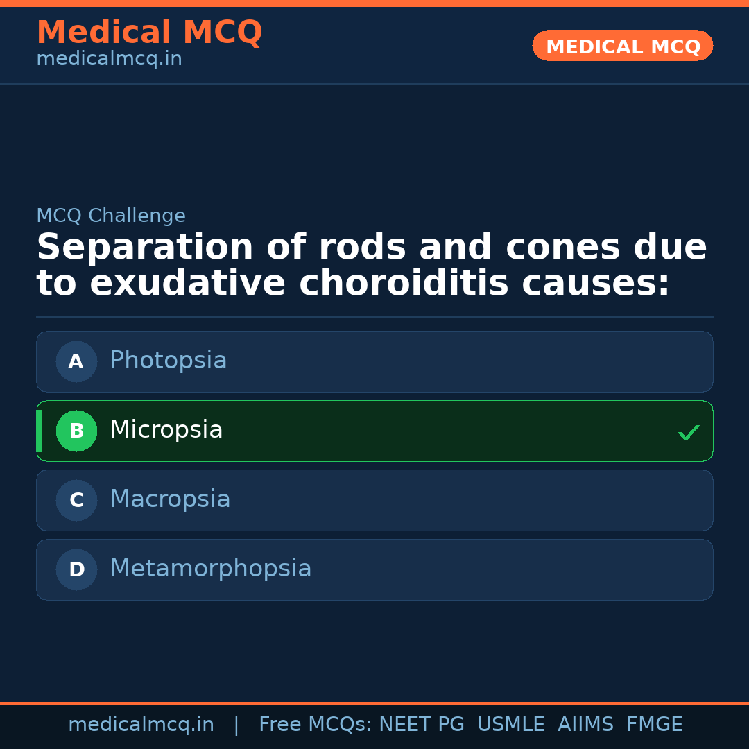 MCQ share card