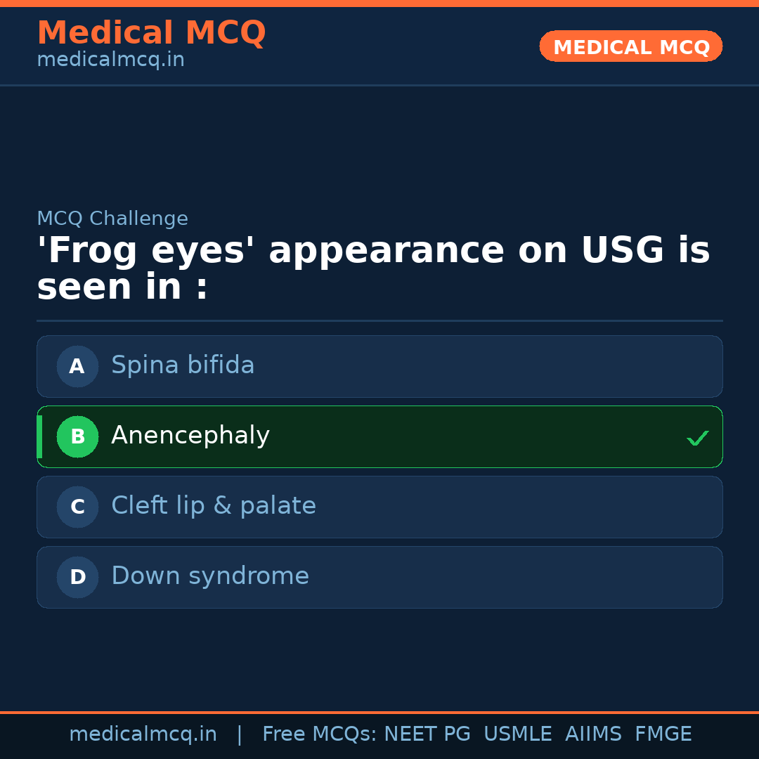 MCQ share card