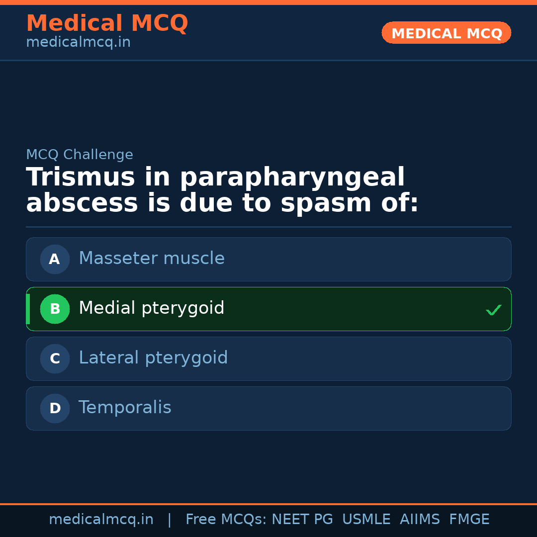 MCQ share card