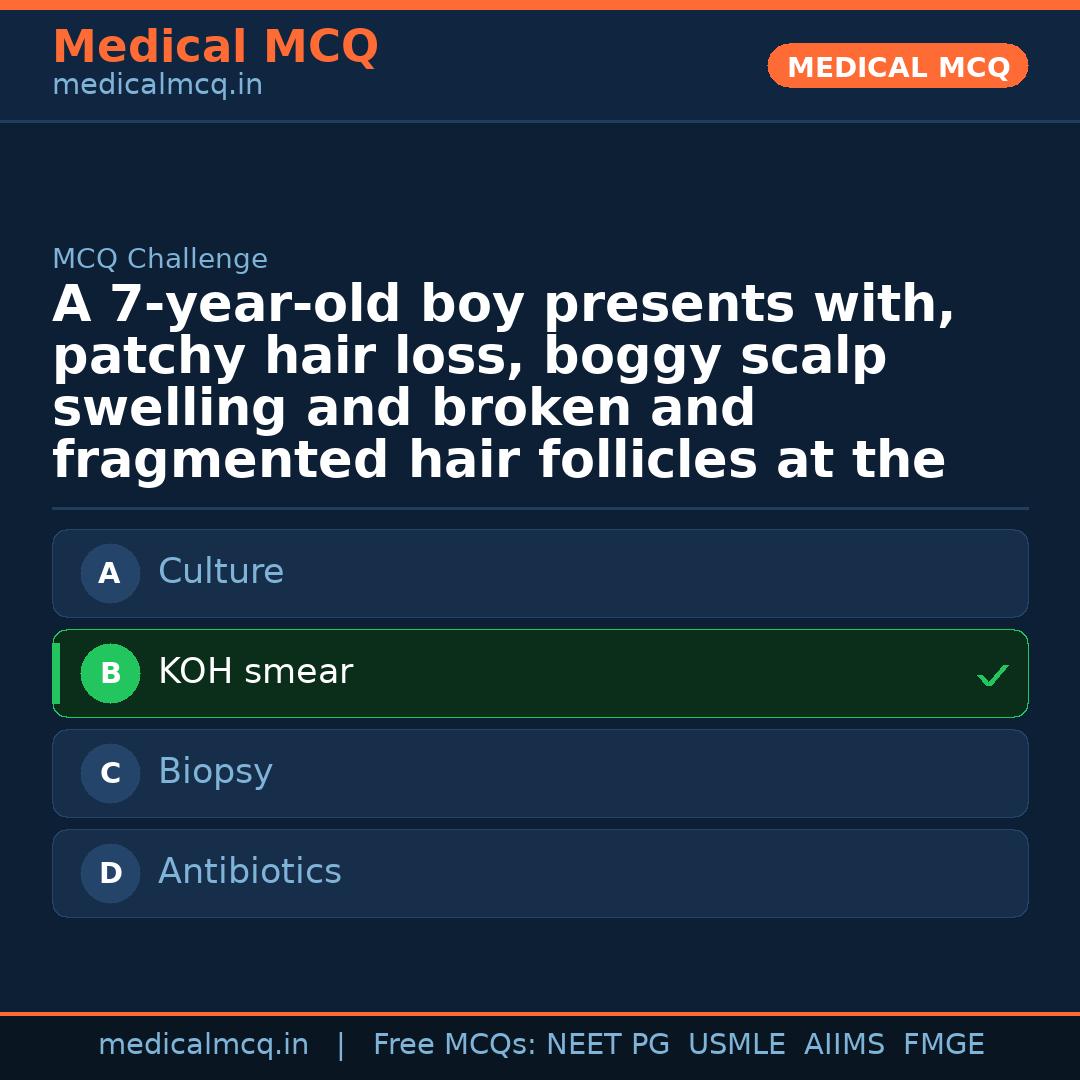 MCQ share card