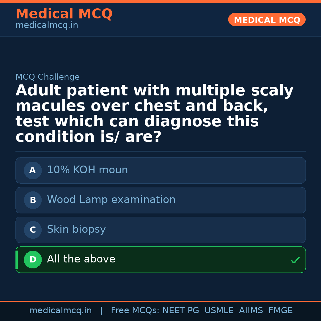 MCQ share card