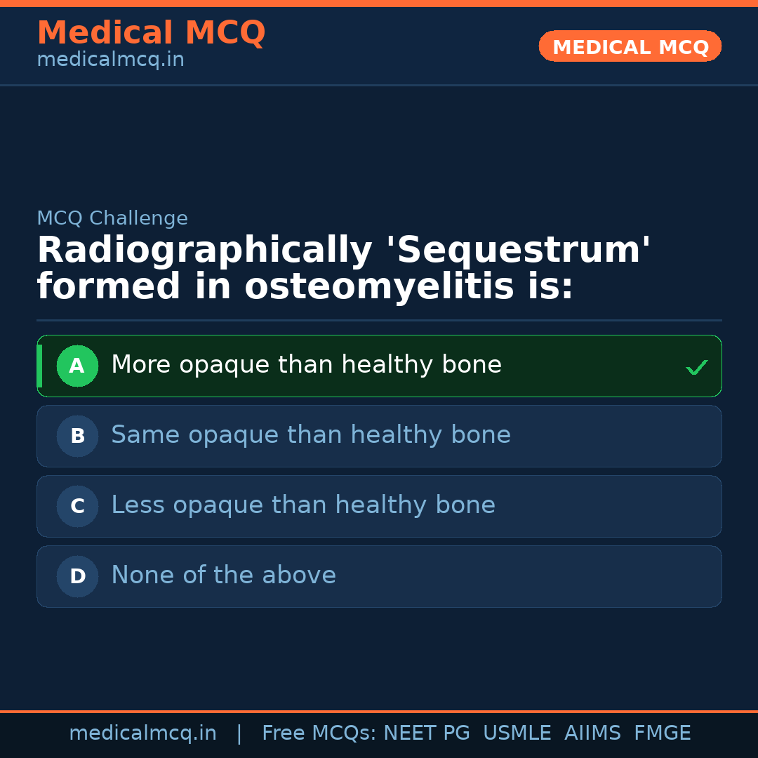 MCQ share card