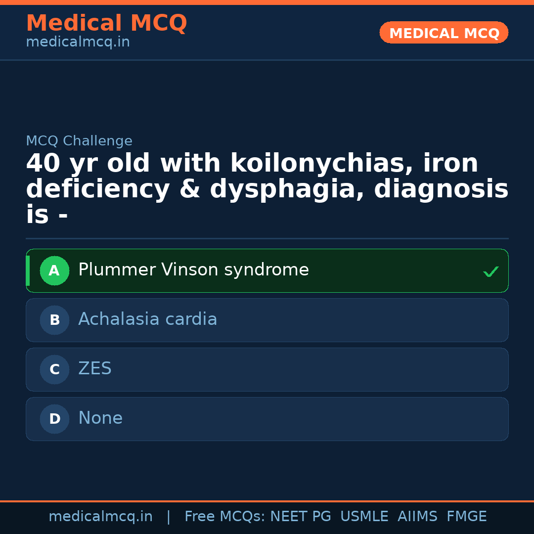 MCQ share card