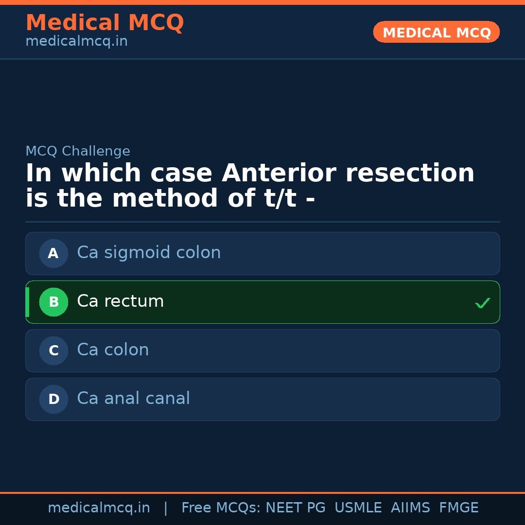 MCQ share card