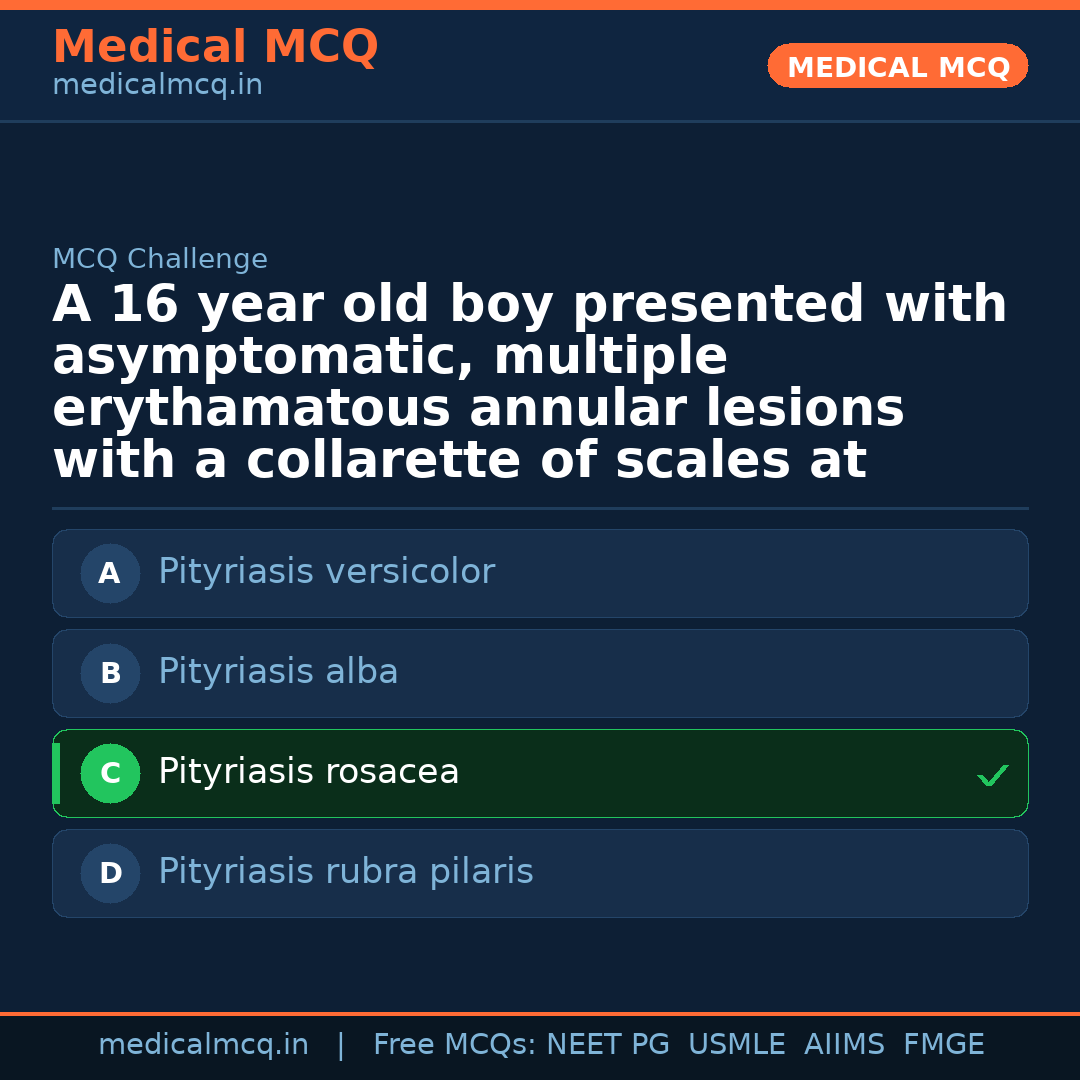 MCQ share card