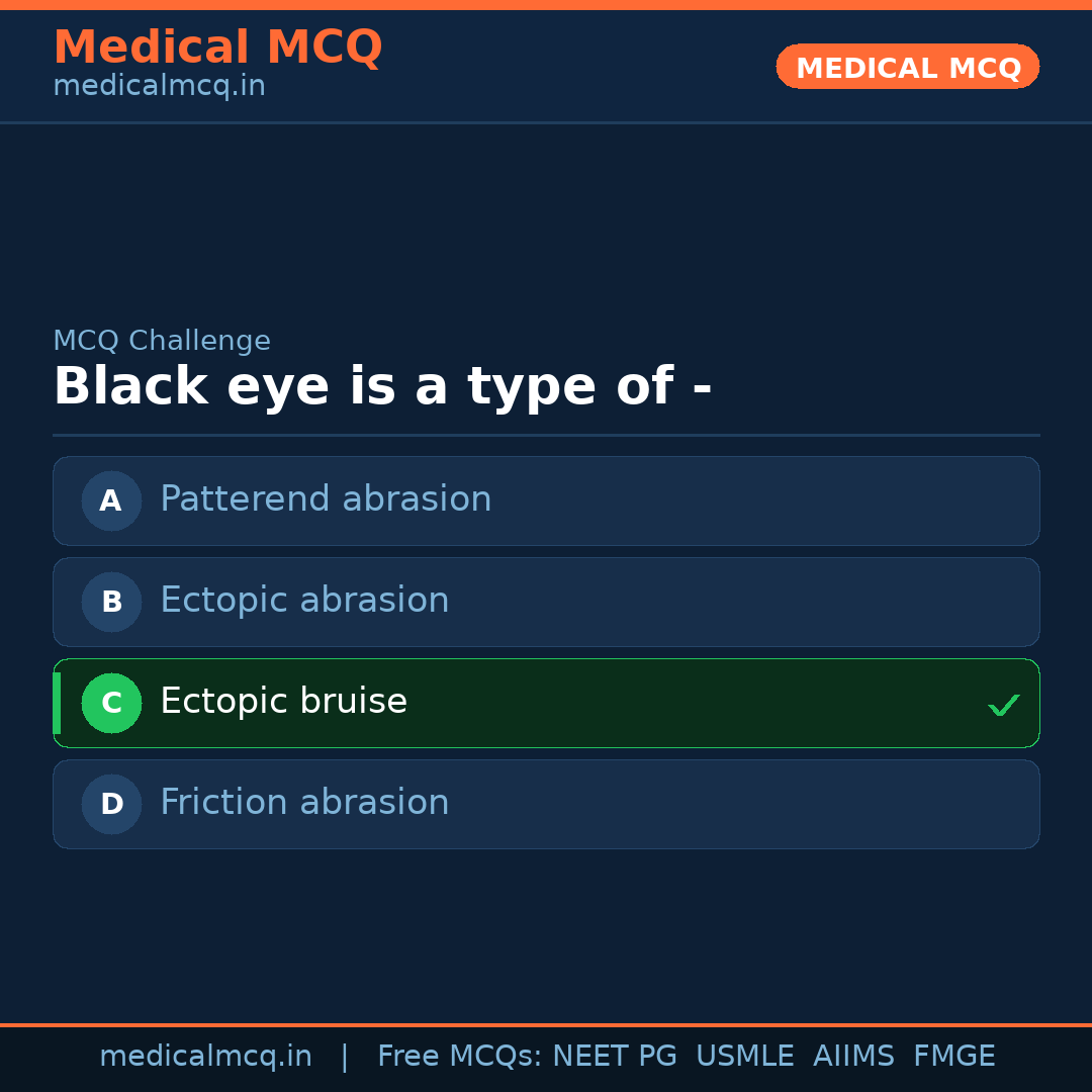 MCQ share card