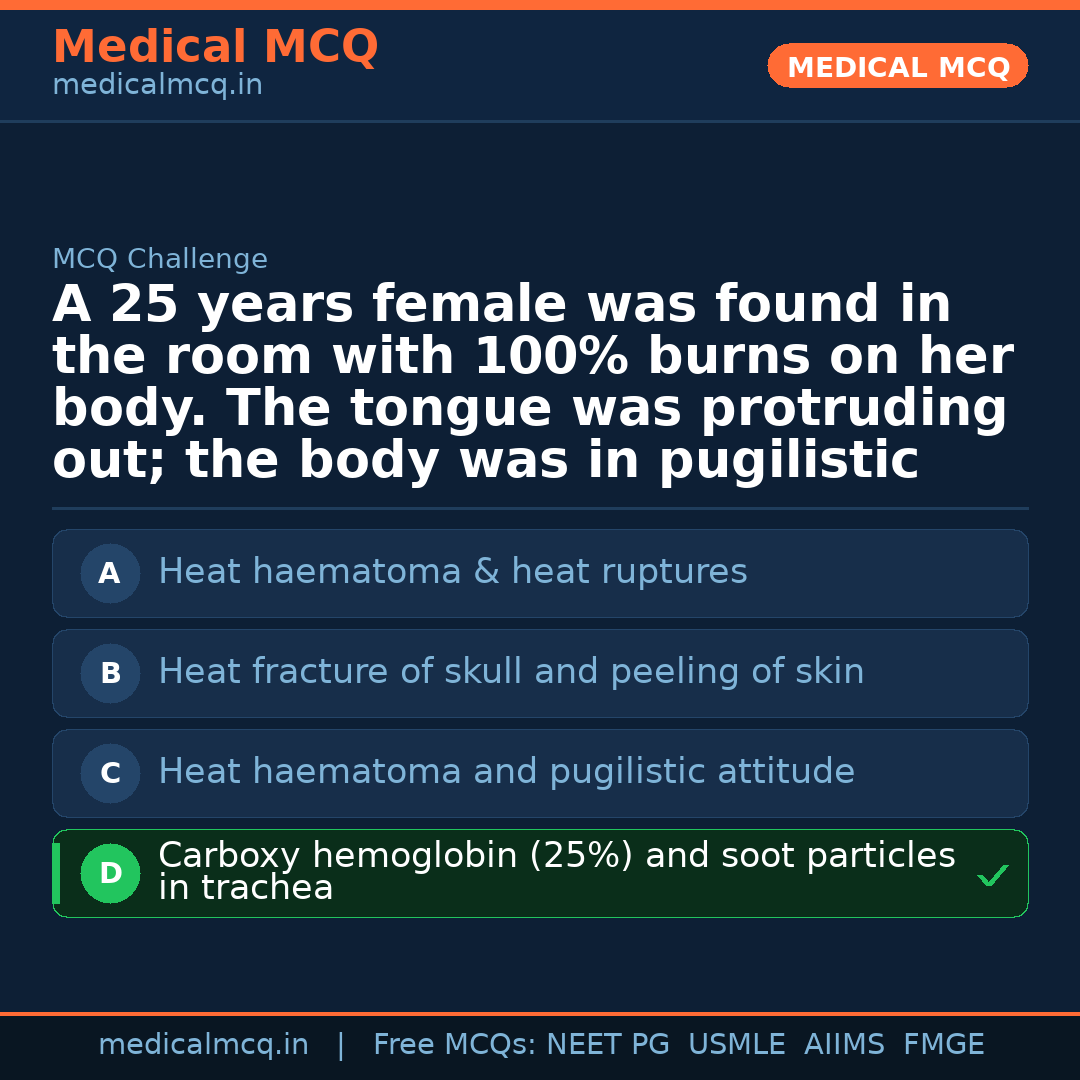 MCQ share card