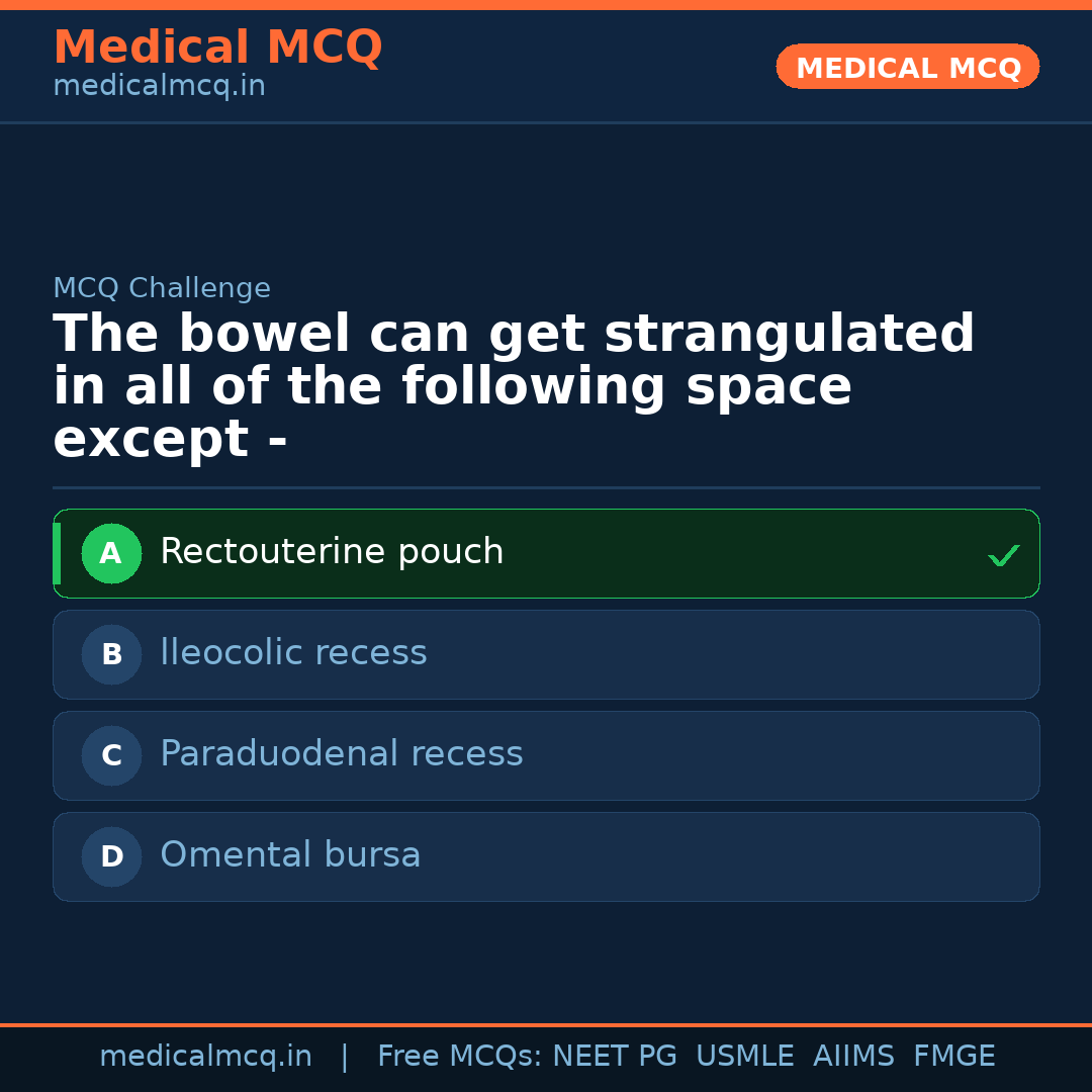MCQ share card