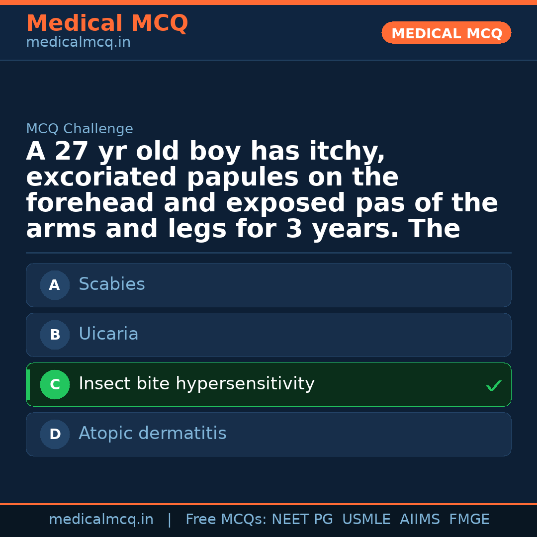MCQ share card