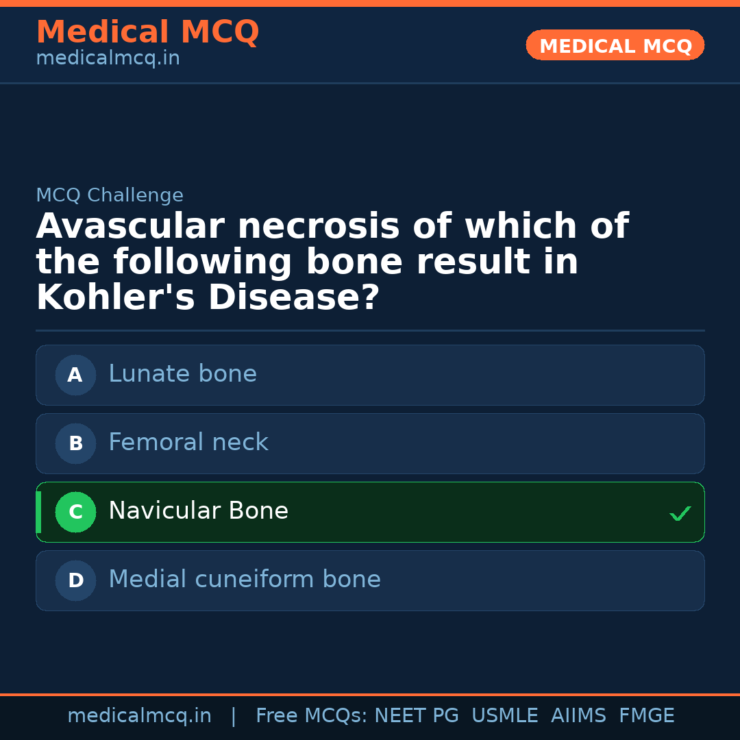 MCQ share card
