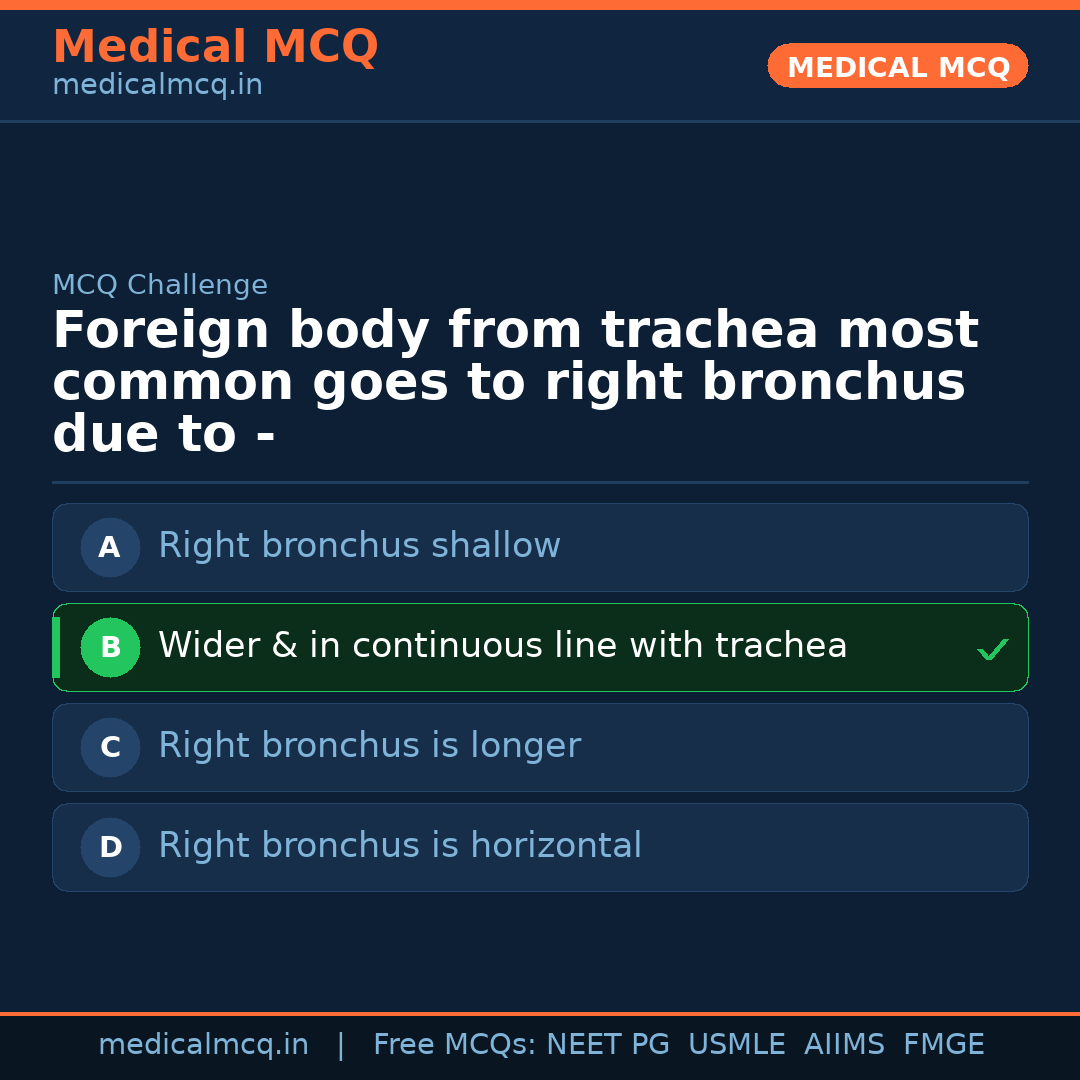 MCQ share card