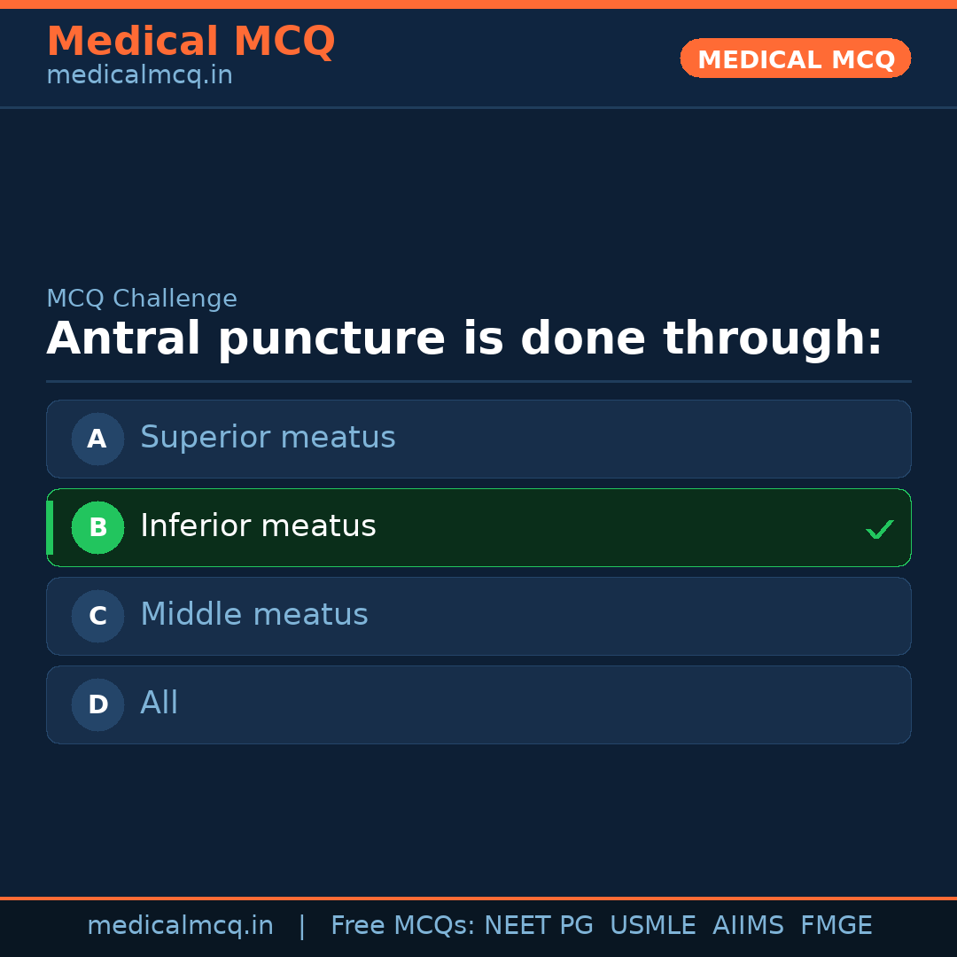 MCQ share card