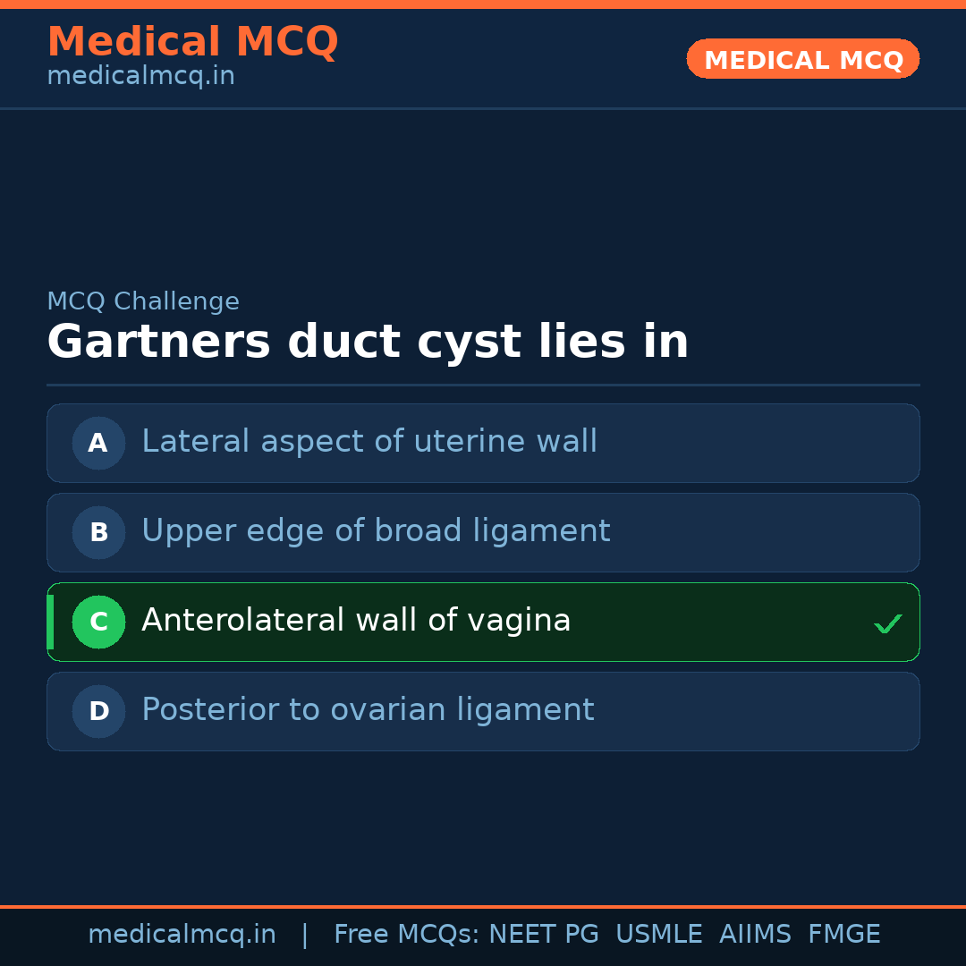 MCQ share card
