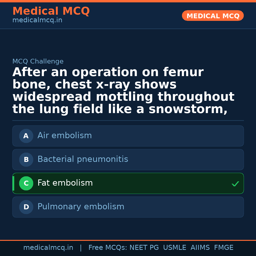 MCQ share card