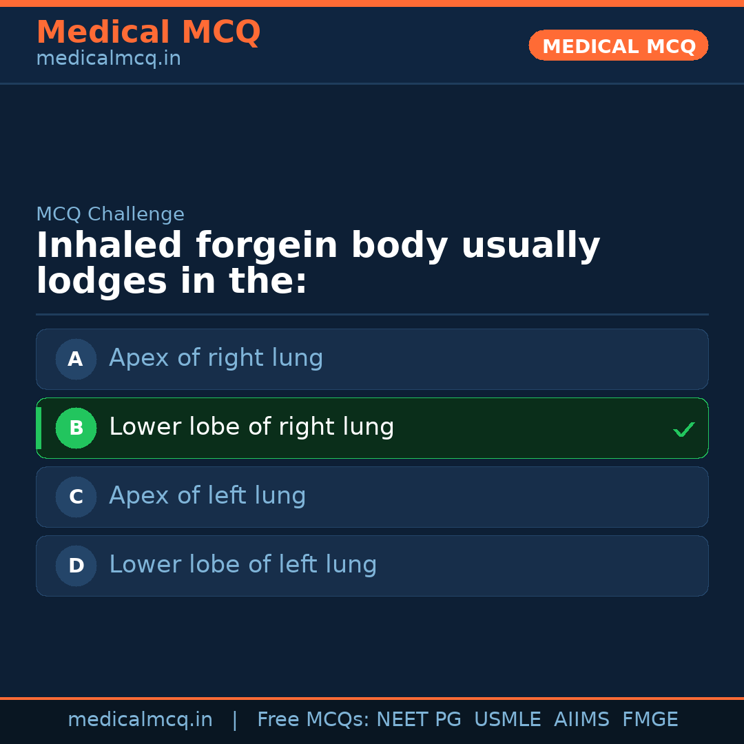 MCQ share card