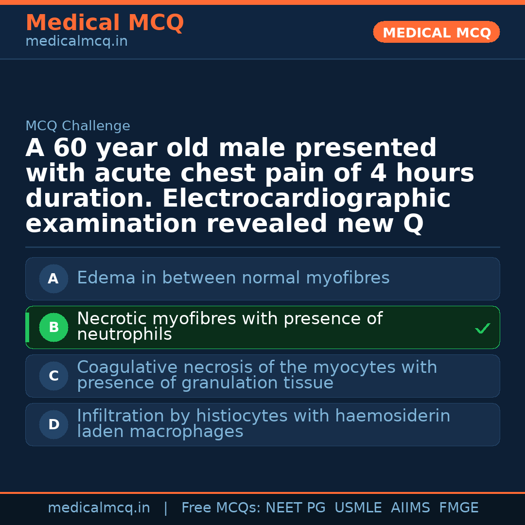 MCQ share card