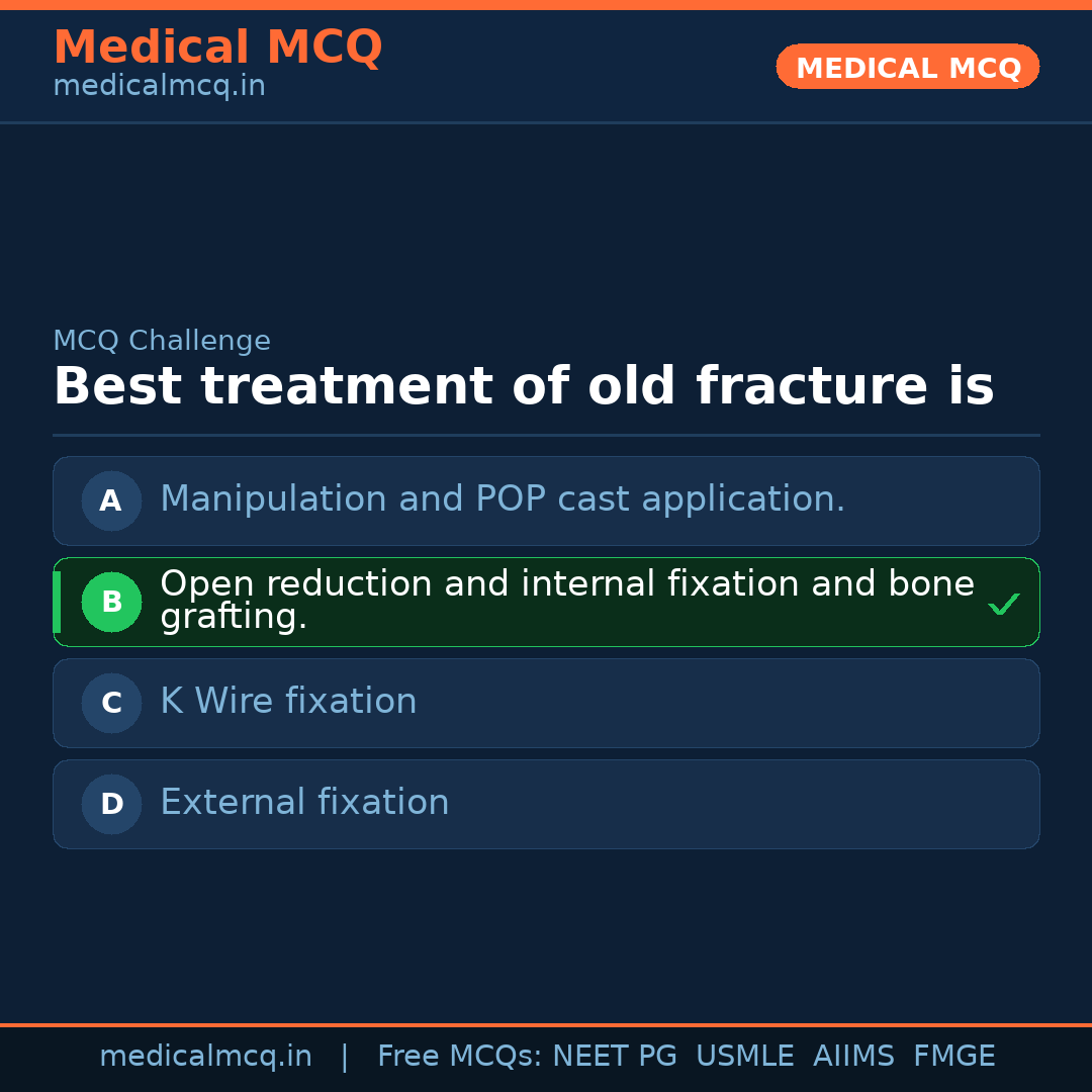 MCQ share card