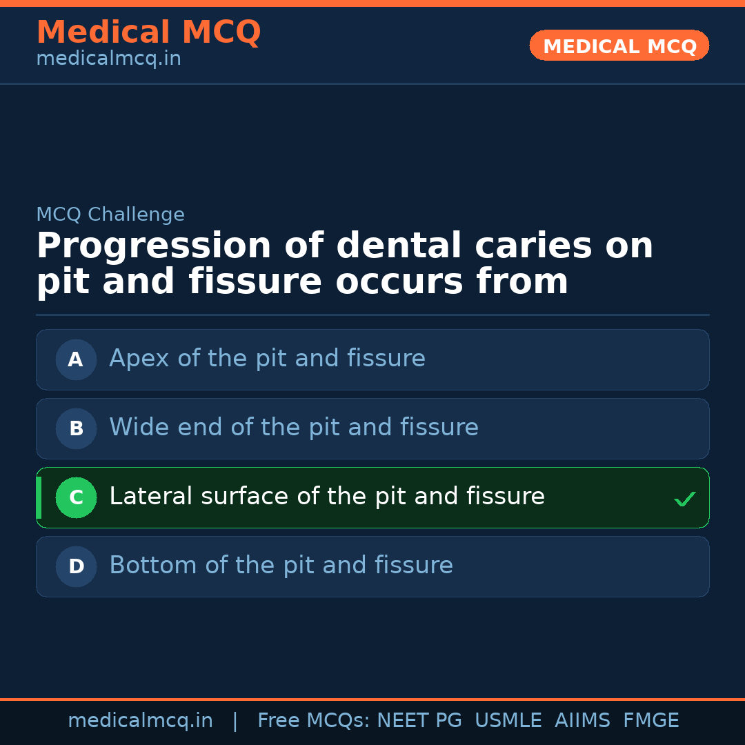 MCQ share card