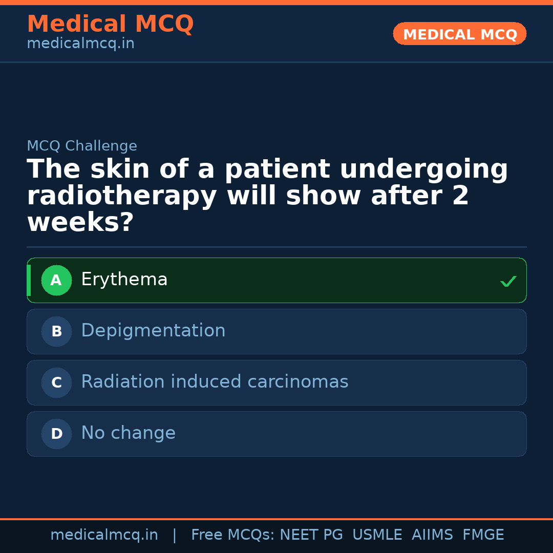 MCQ share card